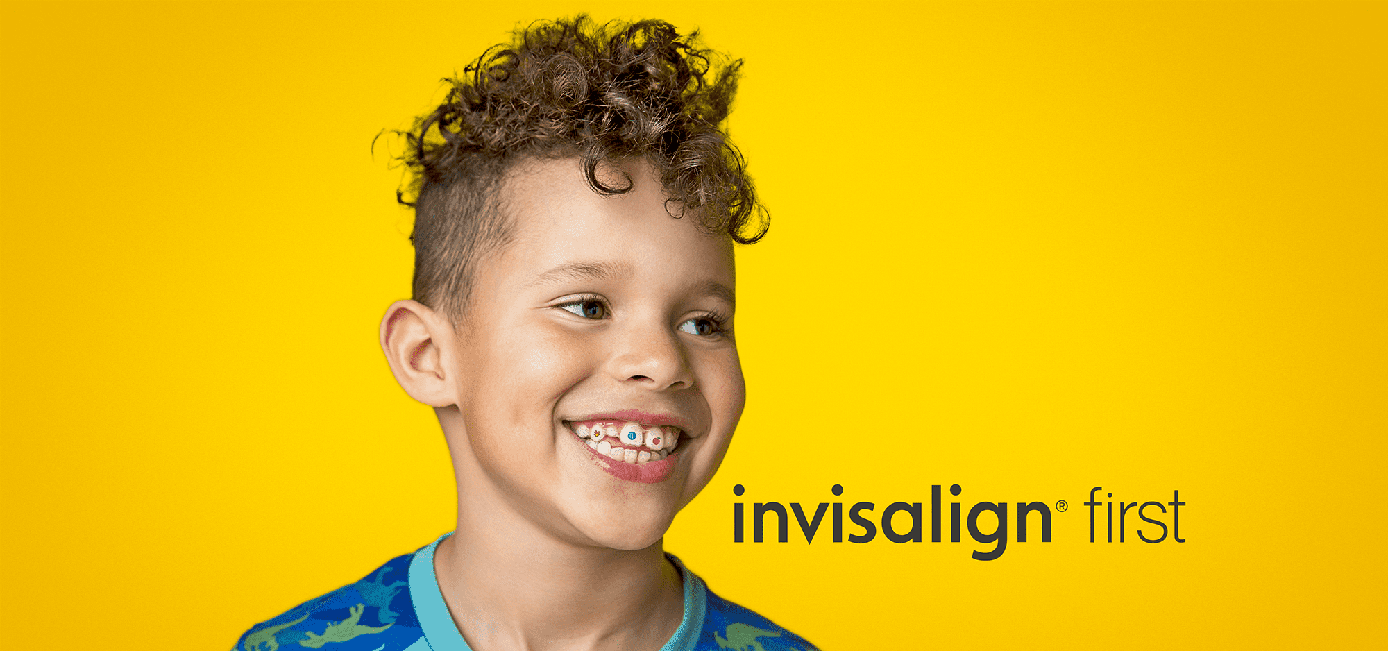 Personalize Your Smile with Invisalign Stickables