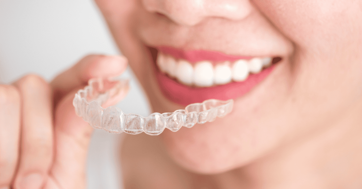 Invisalign Treatable Cases: Gap Teeth